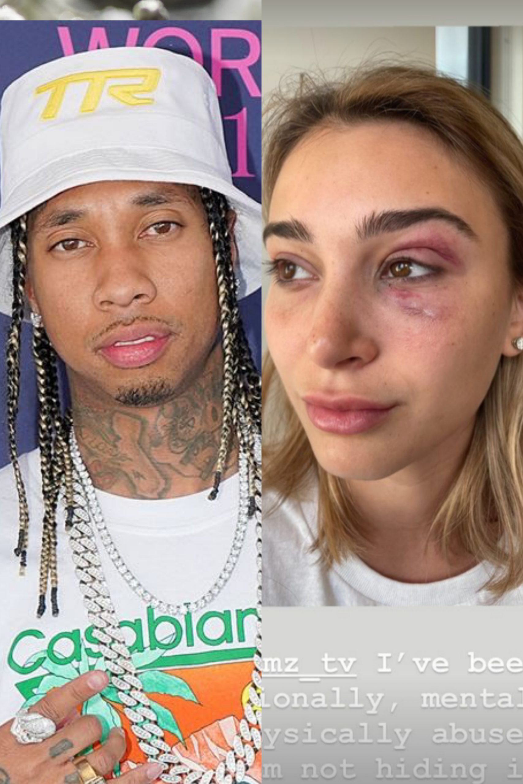 Tyga’s Girlfriend Camaryn Swanson Accused Him Of Domestic Violence