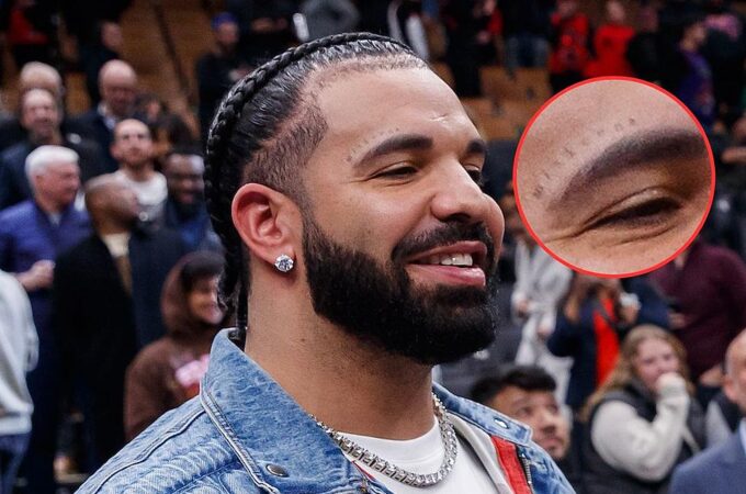 Drake Got New Tattoo “Miskeen” on his Face_ Check it Out